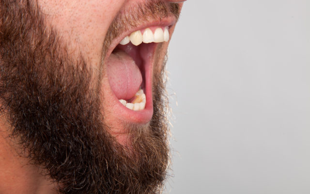 Beards Evolved So Men Can Take A Punch To The Face, Says Study