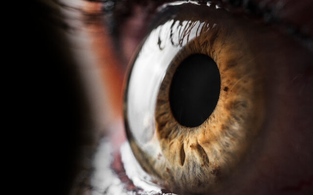 Thinking Of Getting LASIK Eye Surgery? You Might Want To Think Again